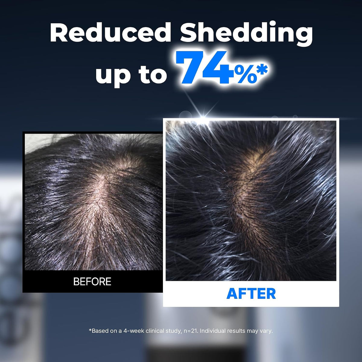 Epais - Scalp Boosting Ampoule